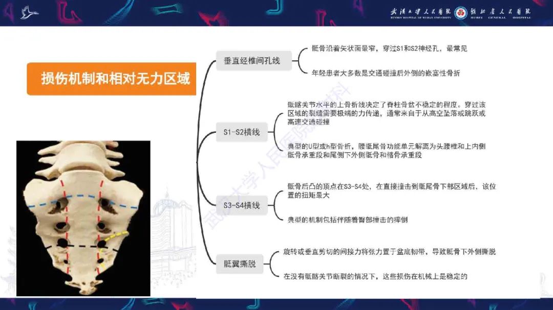 影像PPT - 【PPT】骶骨骨折CT评估-5