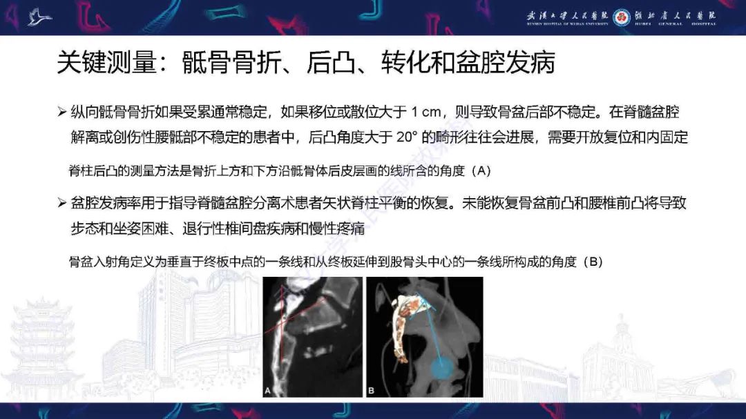 影像PPT - 【PPT】骶骨骨折CT评估-7