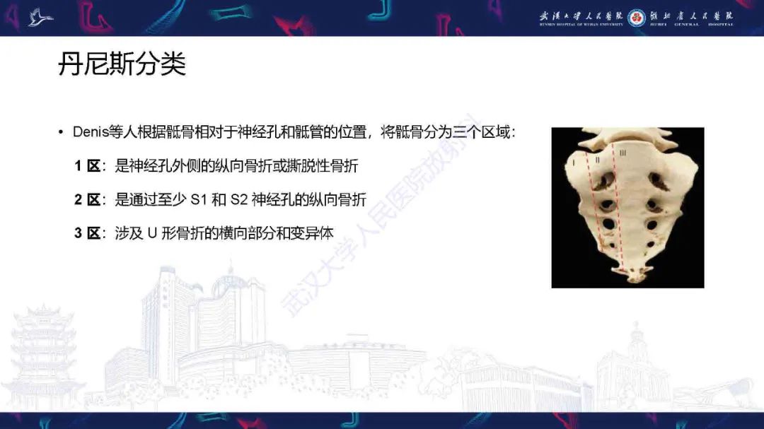 影像PPT - 【PPT】骶骨骨折CT评估-9