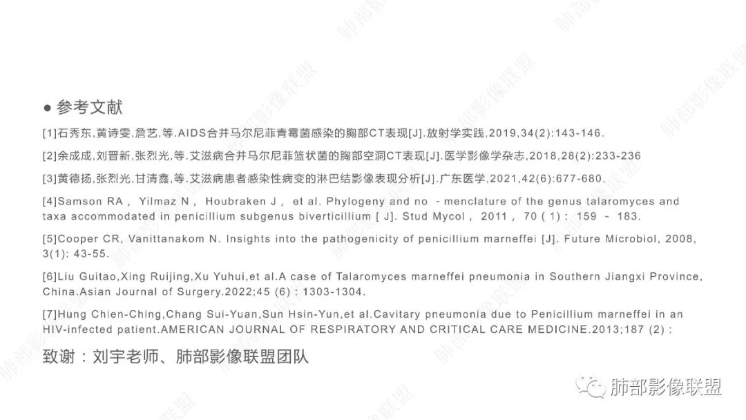 影像PPT - 【PPT】马尔尼菲篮状菌的CT表现-21 影像PPT - 【PPT】马尔尼菲篮状菌的CT表现-21