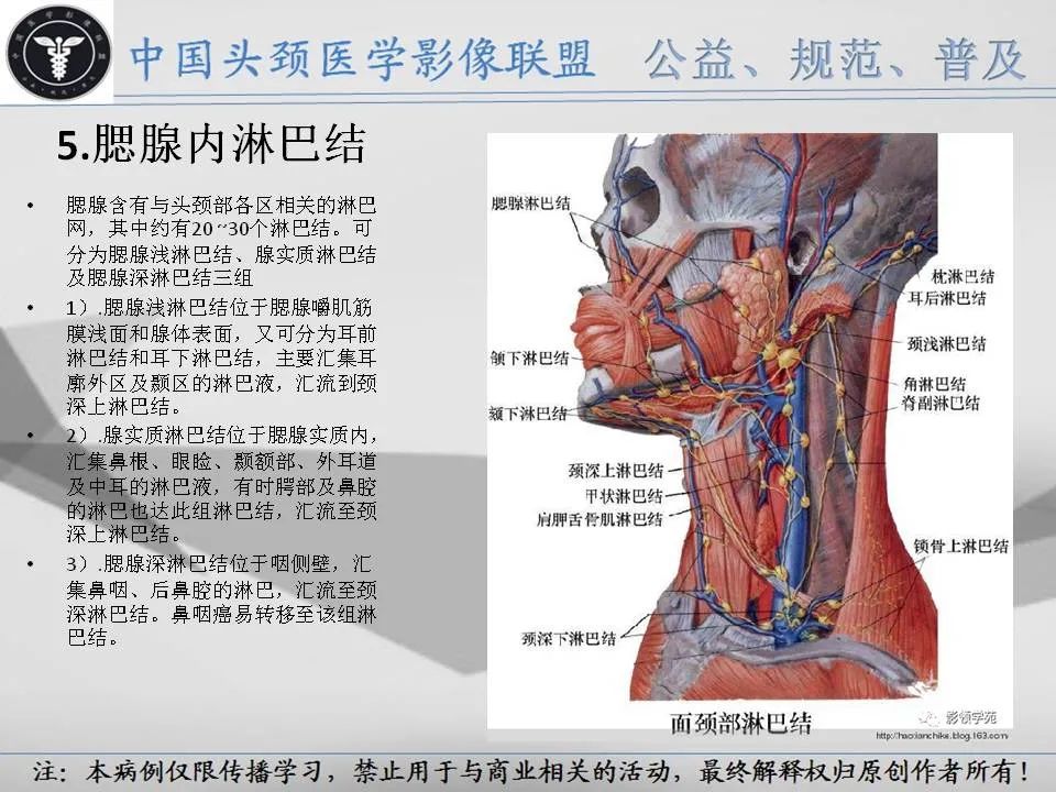 影像PPT - 【PPT】腮腺解剖-9 影像PPT - 【PPT】腮腺解剖-9