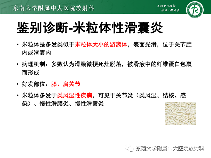 影像PPT - 【PPT】滑膜软骨瘤病-23 影像PPT - 【PPT】滑膜软骨瘤病-23
