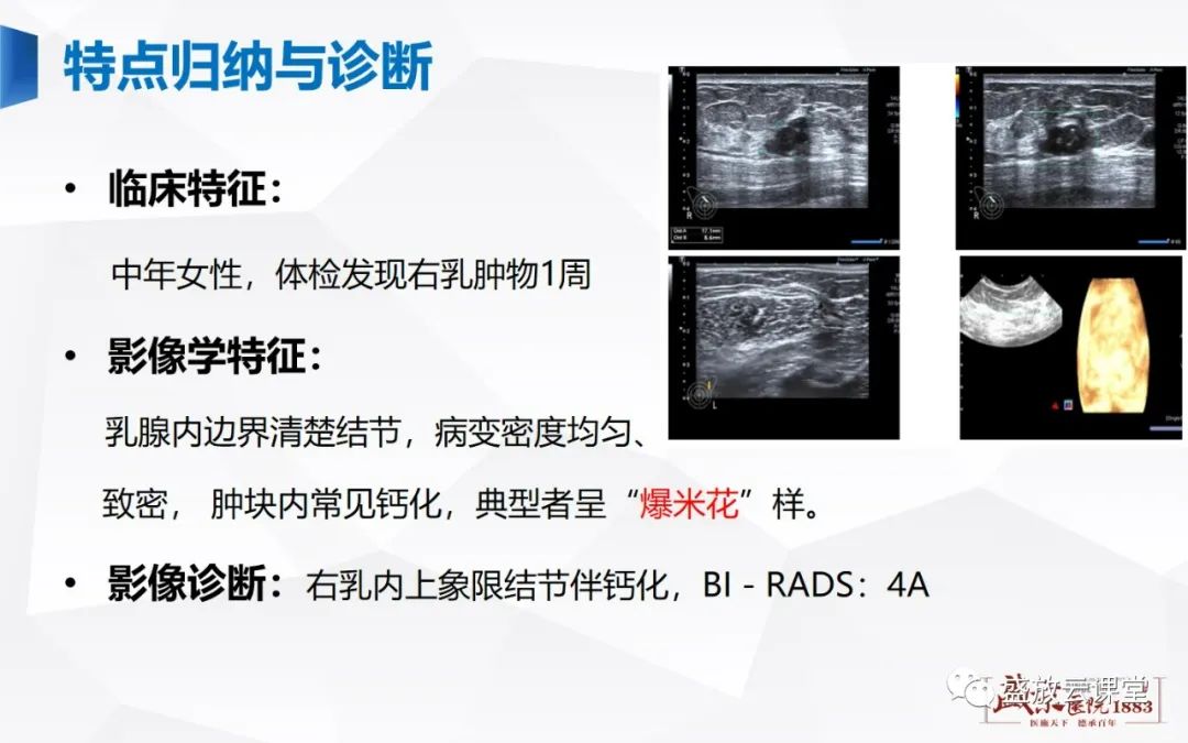 影像PPT - 【PPT】乳腺疾病病例读片-16 影像PPT - 【PPT】乳腺疾病病例读片-16