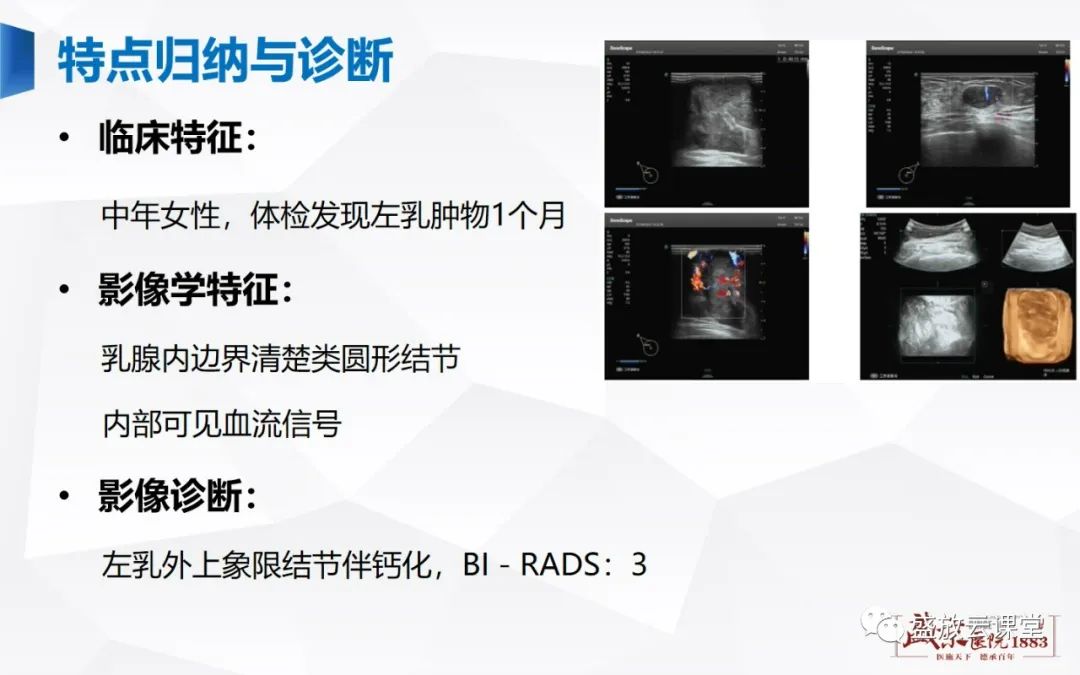 影像PPT - 【PPT】乳腺疾病病例读片-20 影像PPT - 【PPT】乳腺疾病病例读片-20