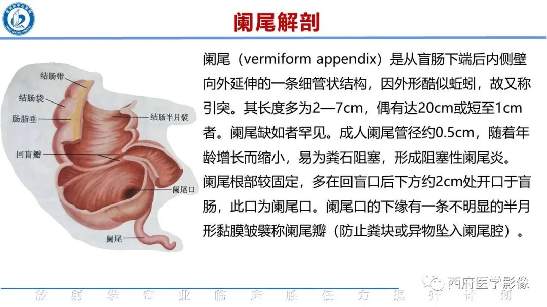 影像PPT - 【PPT】阑尾解剖及阑尾炎影像诊断-2