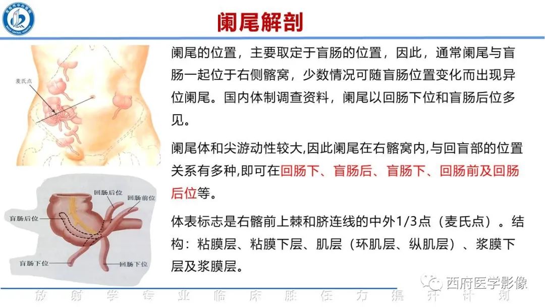 影像PPT - 【PPT】阑尾解剖及阑尾炎影像诊断-3