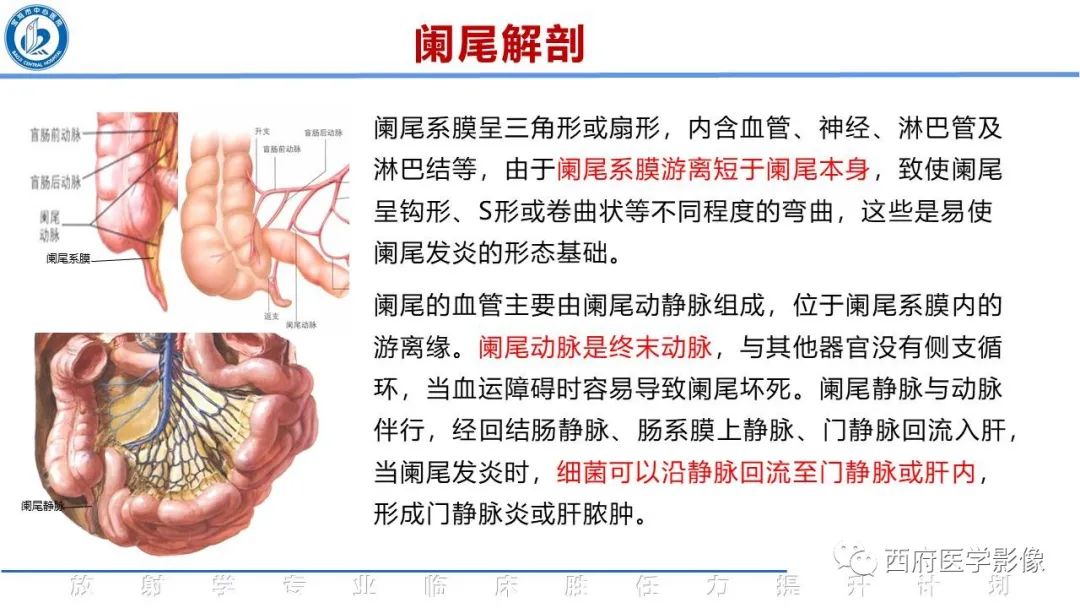 影像PPT - 【PPT】阑尾解剖及阑尾炎影像诊断-4