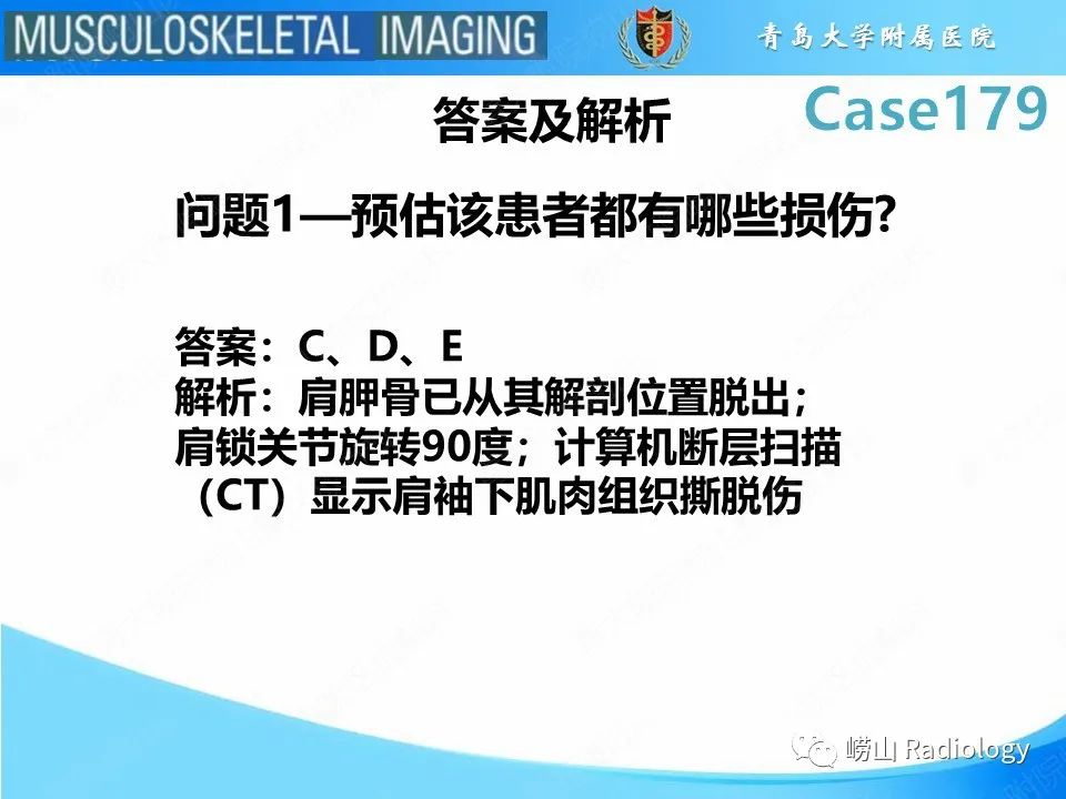 影像PPT - 【PPT】肩胛胸壁分离-4