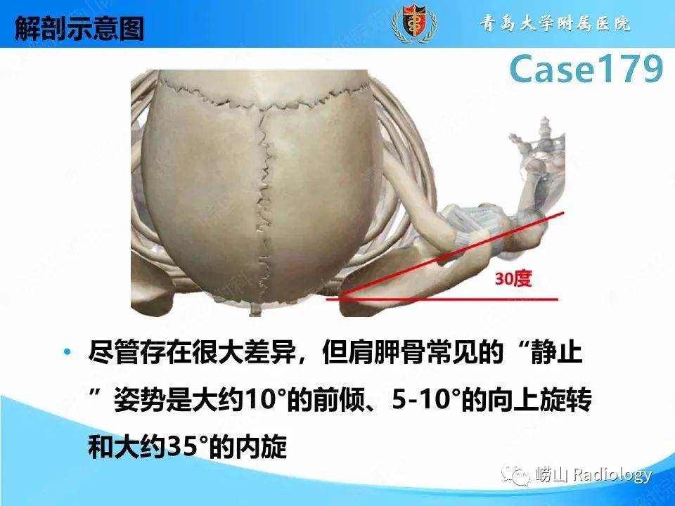 影像PPT - 【PPT】肩胛胸壁分离-13
