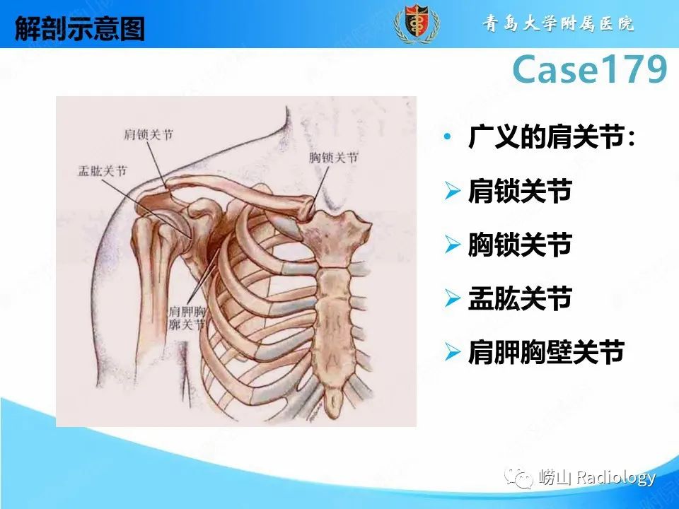 影像PPT - 【PPT】肩胛胸壁分离-15