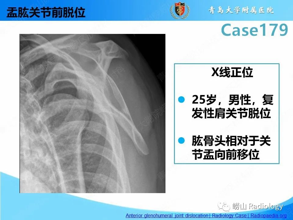 影像PPT - 【PPT】肩胛胸壁分离-24
