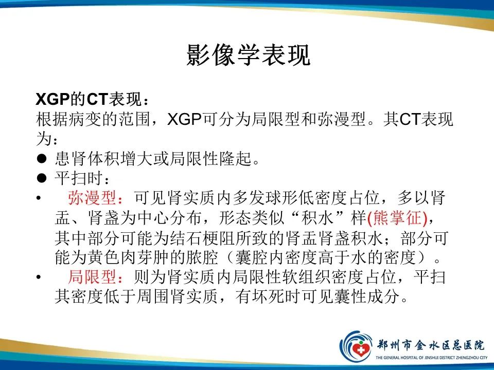 影像PPT - 【PPT】黄色肉芽肿性肾盂肾炎影像表现-15