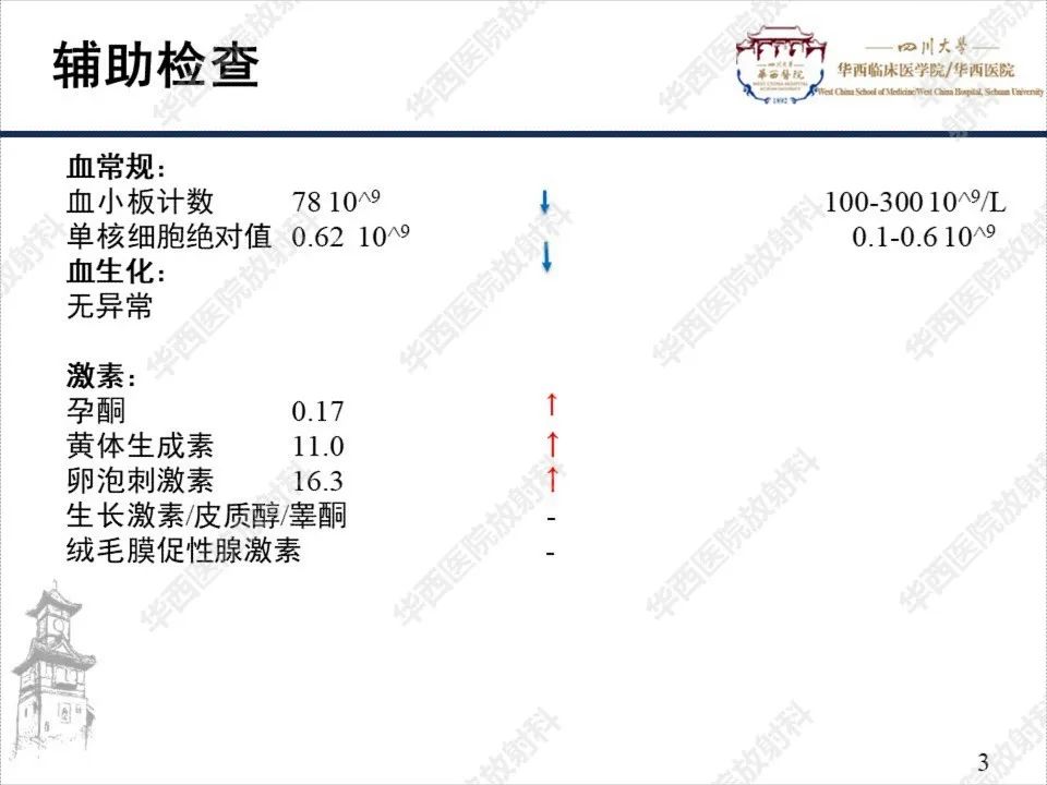 影像PPT - 【PPT】颅咽管瘤1例MR影像鉴别诊断-3
