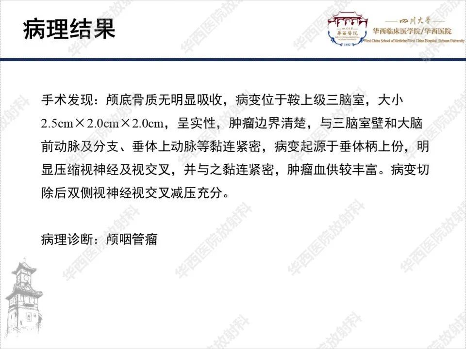 影像PPT - 【PPT】颅咽管瘤1例MR影像鉴别诊断-7