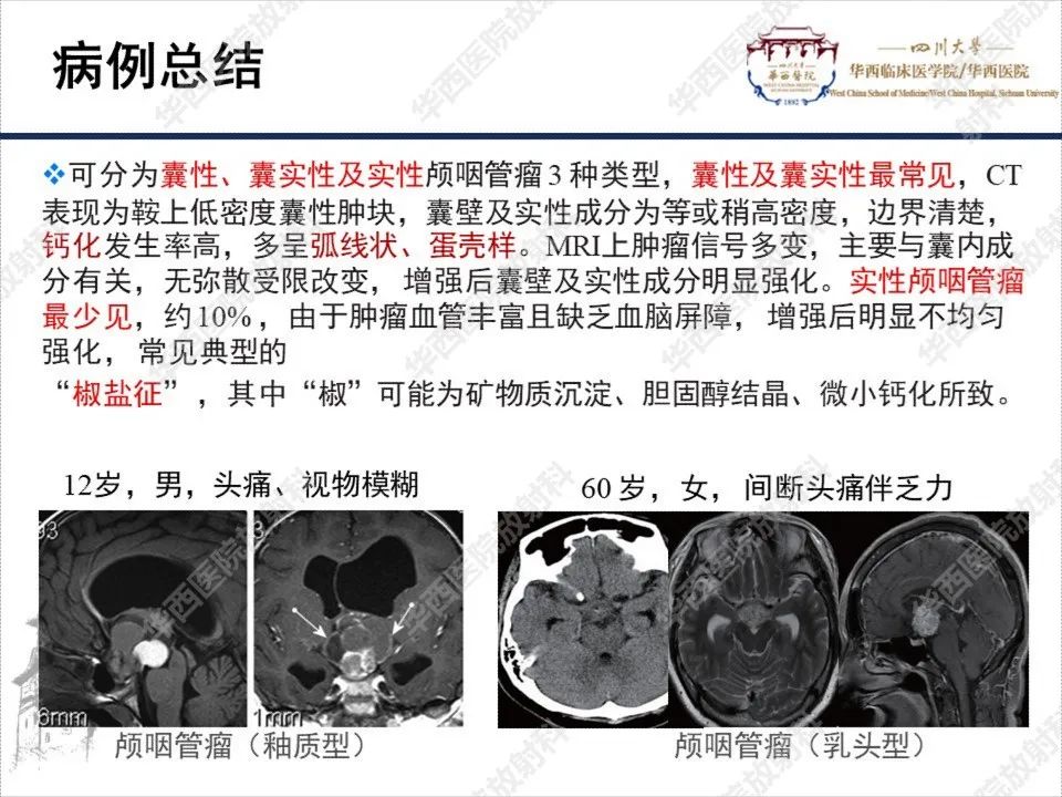 影像PPT - 【PPT】颅咽管瘤1例MR影像鉴别诊断-10