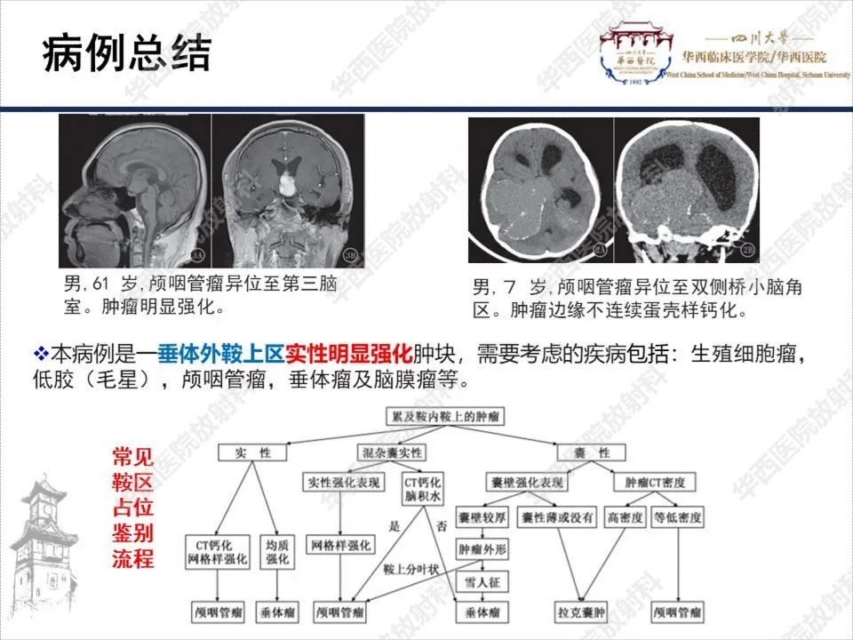 影像PPT - 【PPT】颅咽管瘤1例MR影像鉴别诊断-11