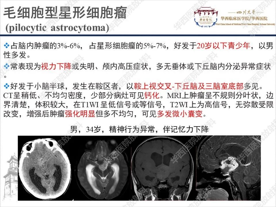 影像PPT - 【PPT】颅咽管瘤1例MR影像鉴别诊断-14