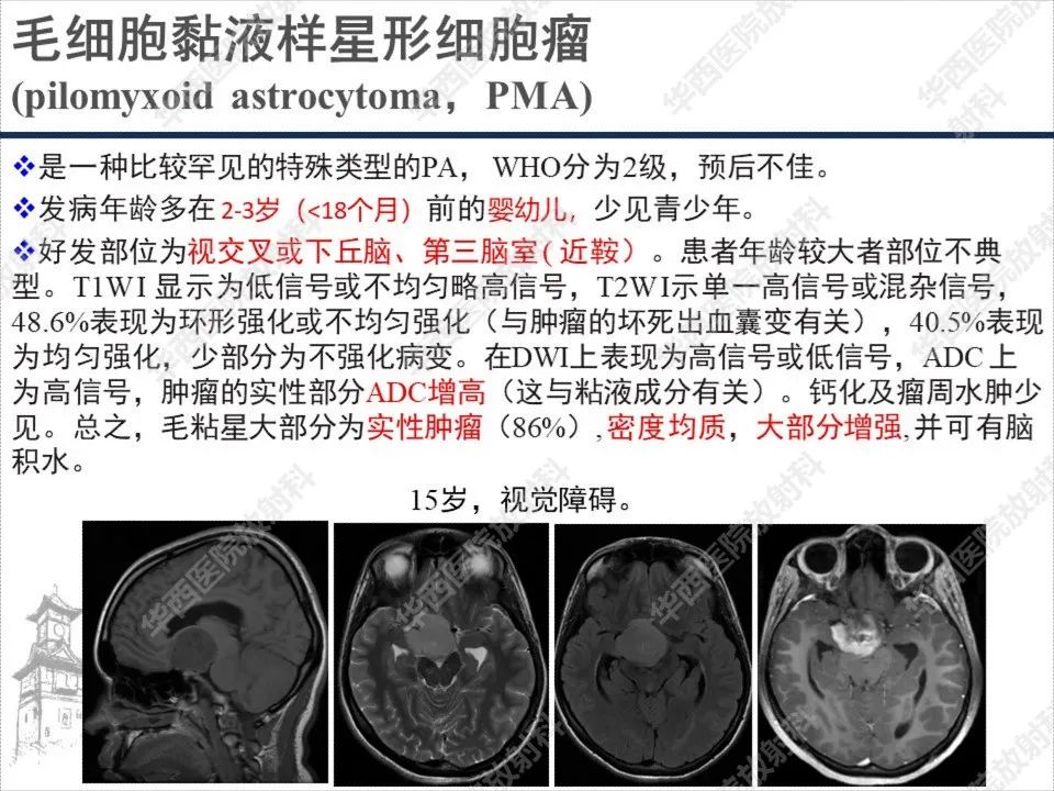 影像PPT - 【PPT】颅咽管瘤1例MR影像鉴别诊断-15