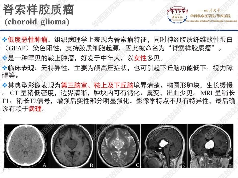 影像PPT - 【PPT】颅咽管瘤1例MR影像鉴别诊断-18
