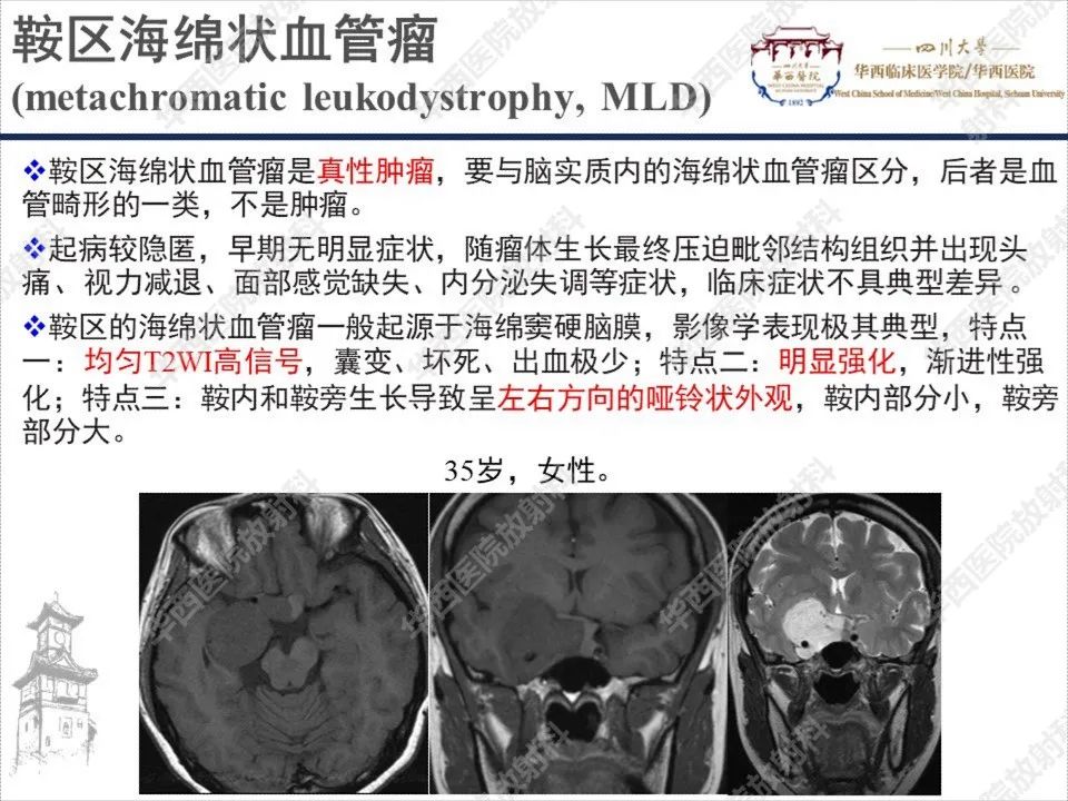 影像PPT - 【PPT】颅咽管瘤1例MR影像鉴别诊断-19