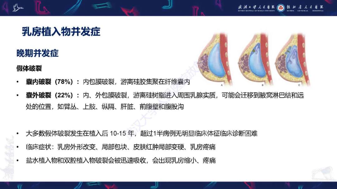 影像PPT - 【PPT】隆胸术后并发症MRI诊断-23