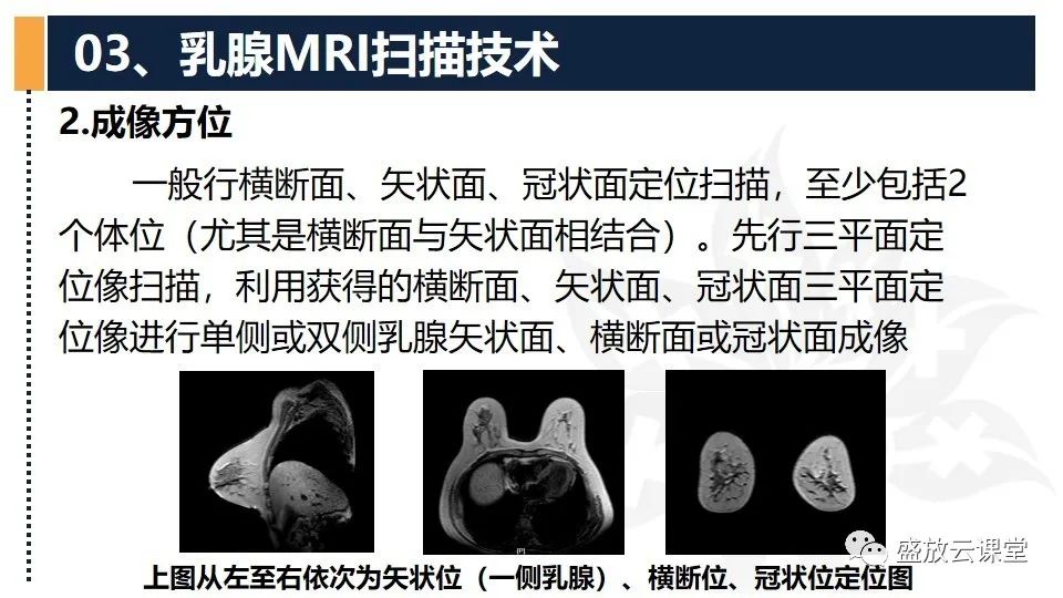 影像PPT - 【PPT】乳腺磁共振检查技术-10