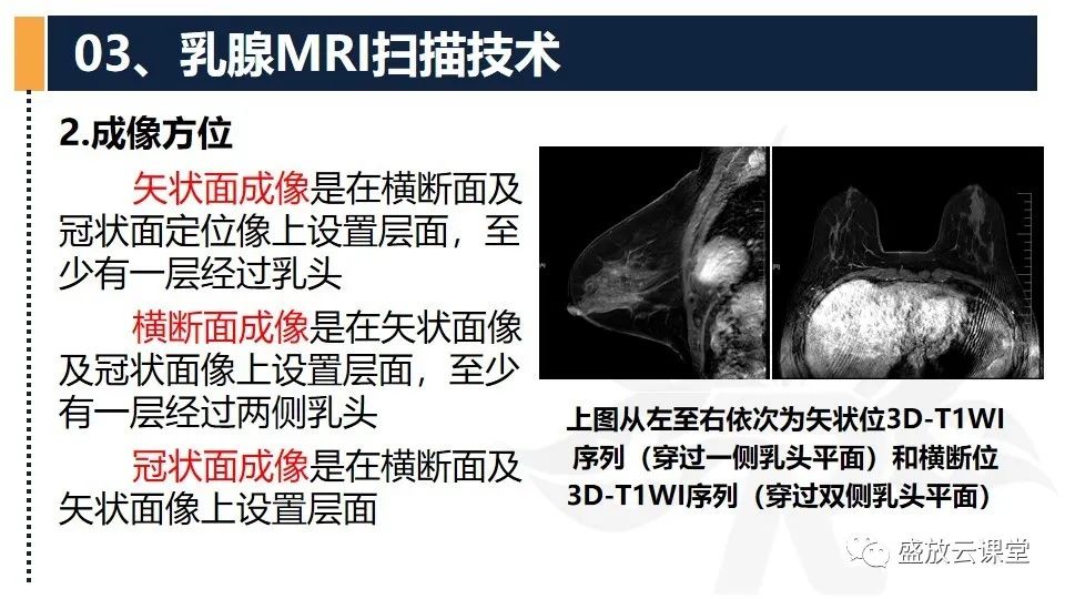 影像PPT - 【PPT】乳腺磁共振检查技术-11