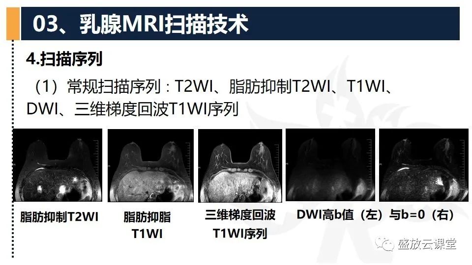 影像PPT - 【PPT】乳腺磁共振检查技术-14
