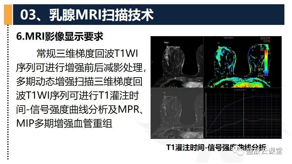 影像PPT - 【PPT】乳腺磁共振检查技术-18