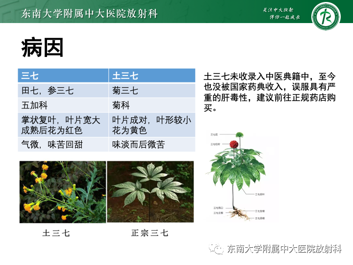 影像PPT - 【PPT】肝窦阻塞综合征-8 影像PPT - 【PPT】肝窦阻塞综合征-8