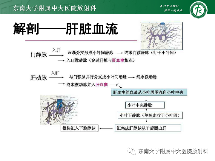 影像PPT - 【PPT】肝窦阻塞综合征-10 影像PPT - 【PPT】肝窦阻塞综合征-10