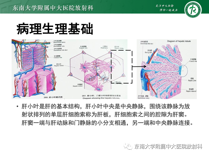 影像PPT - 【PPT】肝窦阻塞综合征-11 影像PPT - 【PPT】肝窦阻塞综合征-11