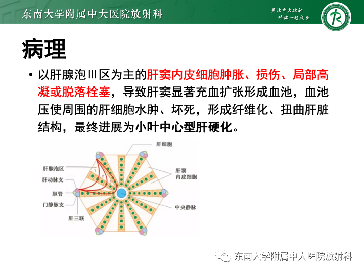 影像PPT - 【PPT】肝窦阻塞综合征-12 影像PPT - 【PPT】肝窦阻塞综合征-12