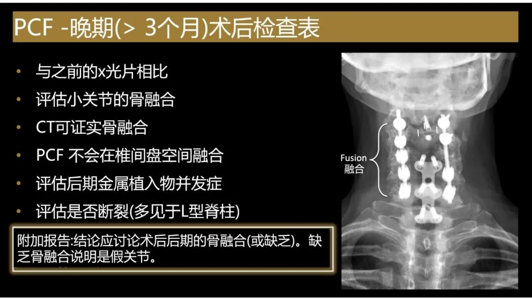 影像PPT - 【PPT】评估围手术期脊柱:除了退行性椎间盘疾病和金属植入物的并发症外-4