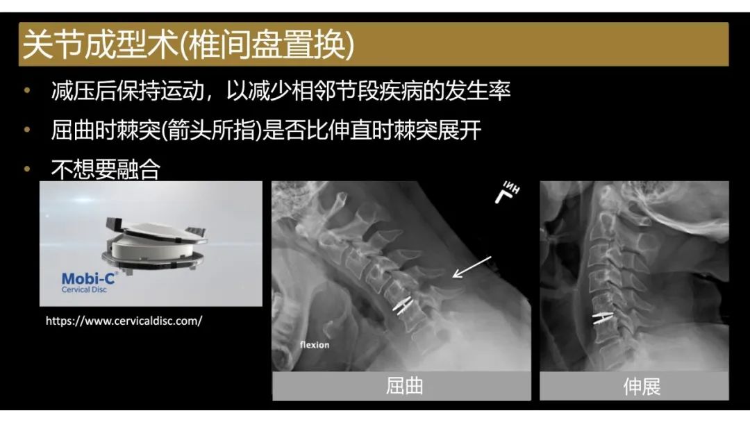 影像PPT - 【PPT】评估围手术期脊柱:除了退行性椎间盘疾病和金属植入物的并发症外-10