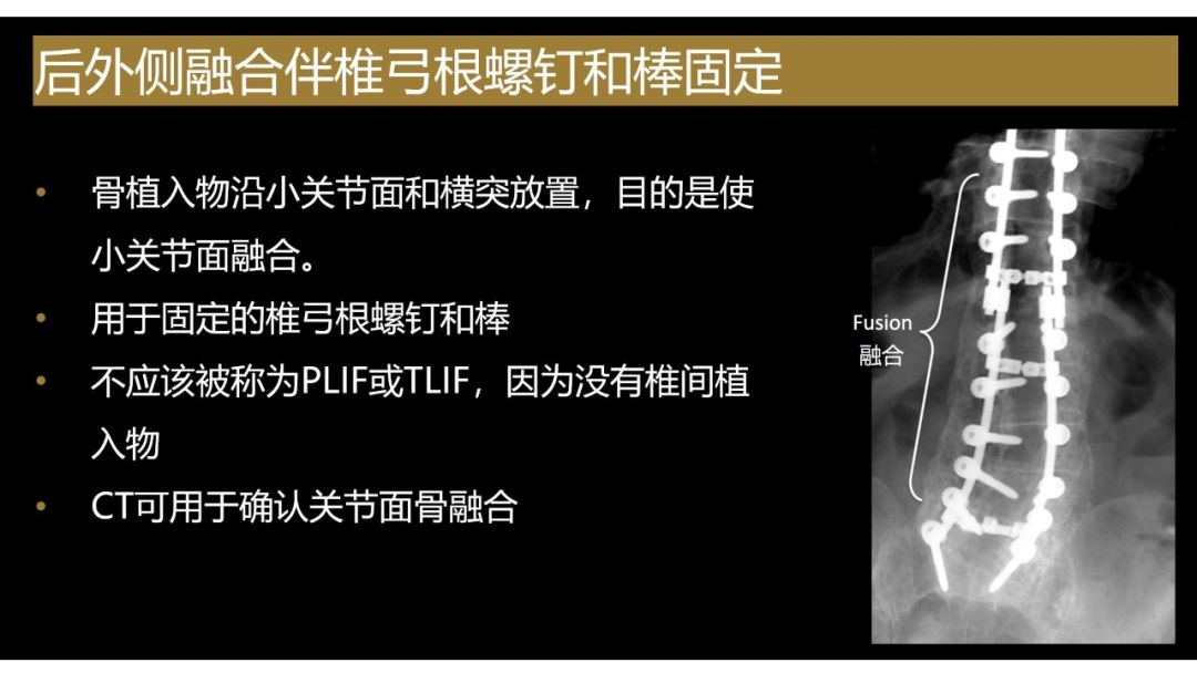 影像PPT - 【PPT】评估围手术期脊柱:除了退行性椎间盘疾病和金属植入物的并发症外-14