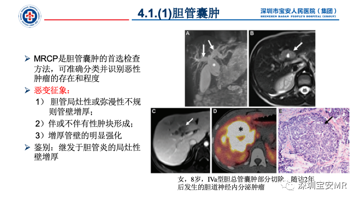影像PPT - 【PPT】胆道系统癌前病变及病理对照-8