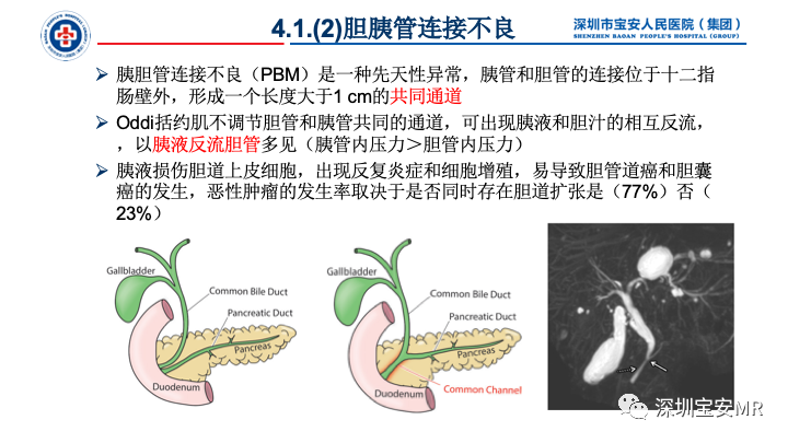 影像PPT - 【PPT】胆道系统癌前病变及病理对照-10