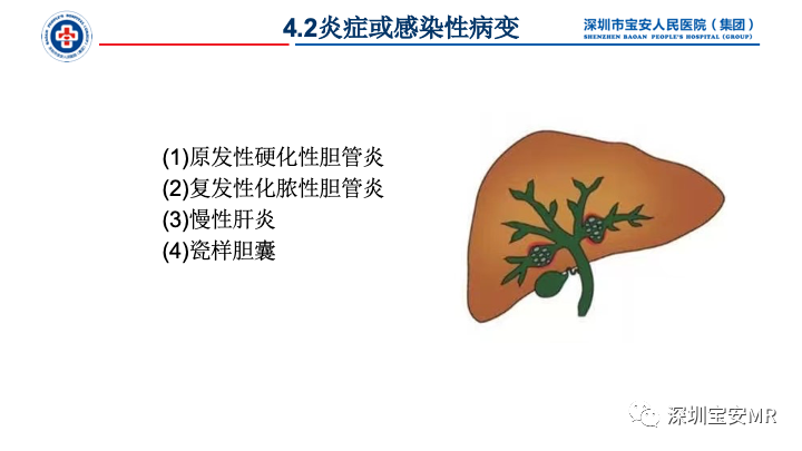 影像PPT - 【PPT】胆道系统癌前病变及病理对照-13