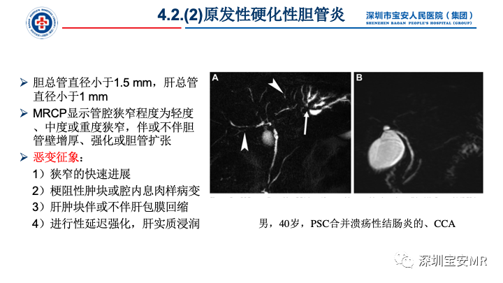 影像PPT - 【PPT】胆道系统癌前病变及病理对照-15