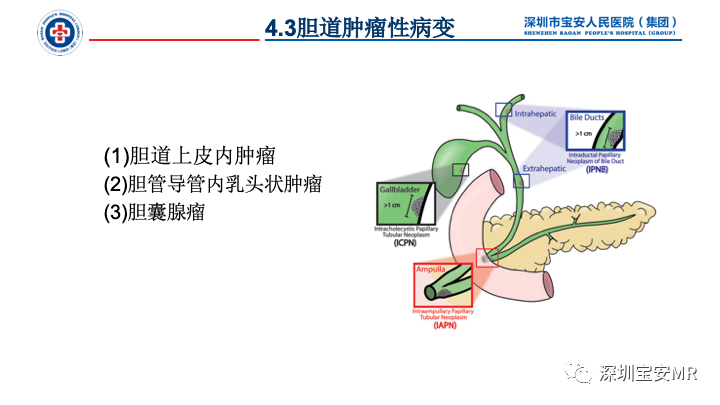 影像PPT - 【PPT】胆道系统癌前病变及病理对照-23