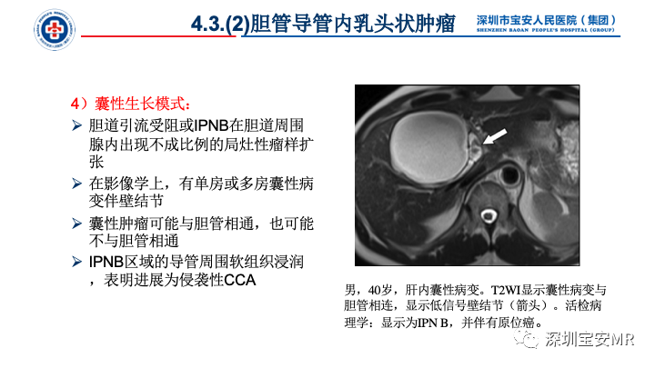 影像PPT - 【PPT】胆道系统癌前病变及病理对照-31