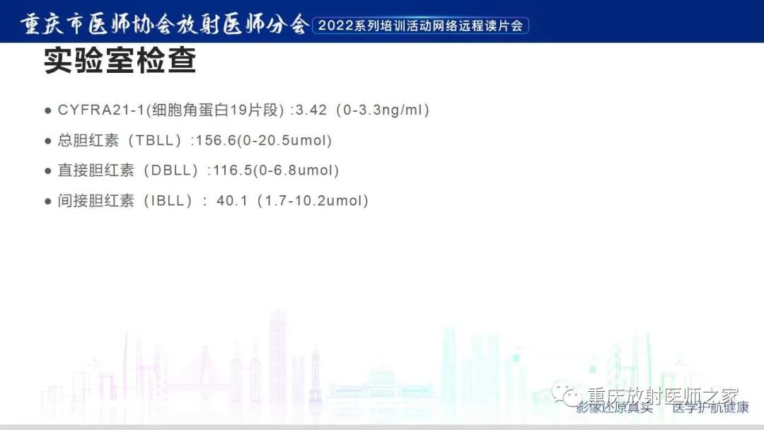 影像PPT - 【病例】肿块型胰腺炎1例CT及MR影像-3