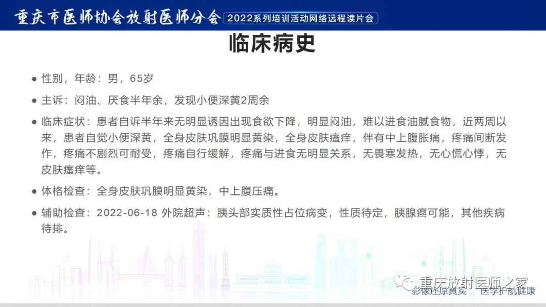 影像PPT - 【病例】肿块型胰腺炎1例CT及MR影像-2