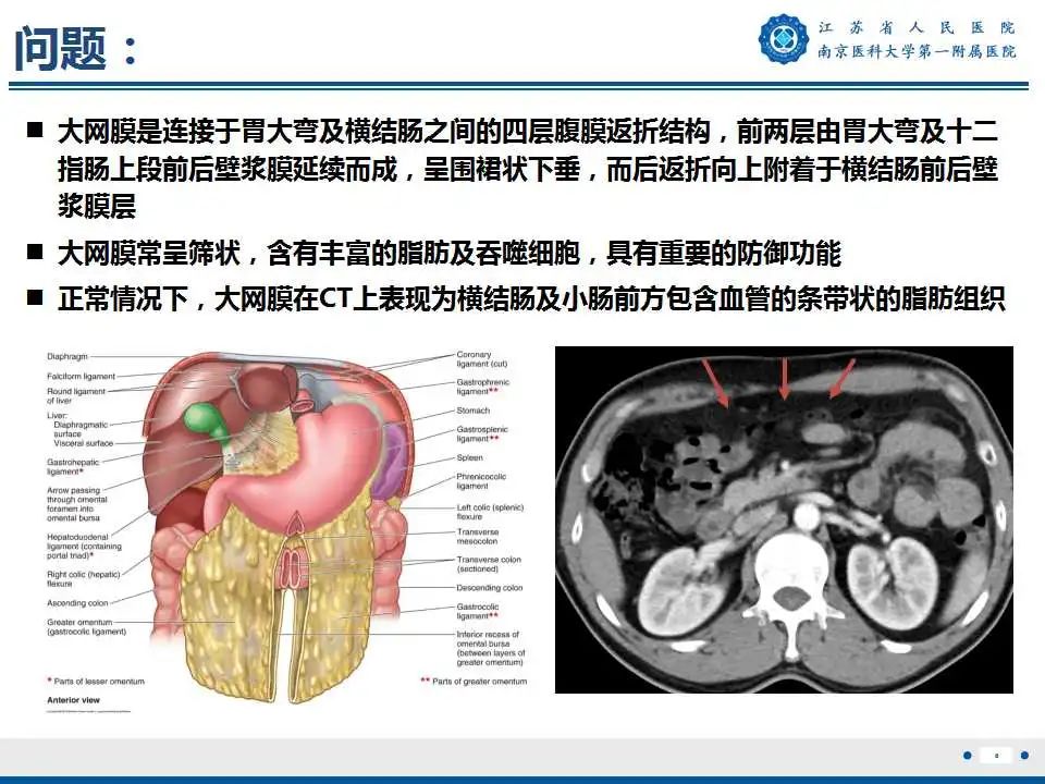 影像PPT - 【PPT】卵巢上皮癌-9