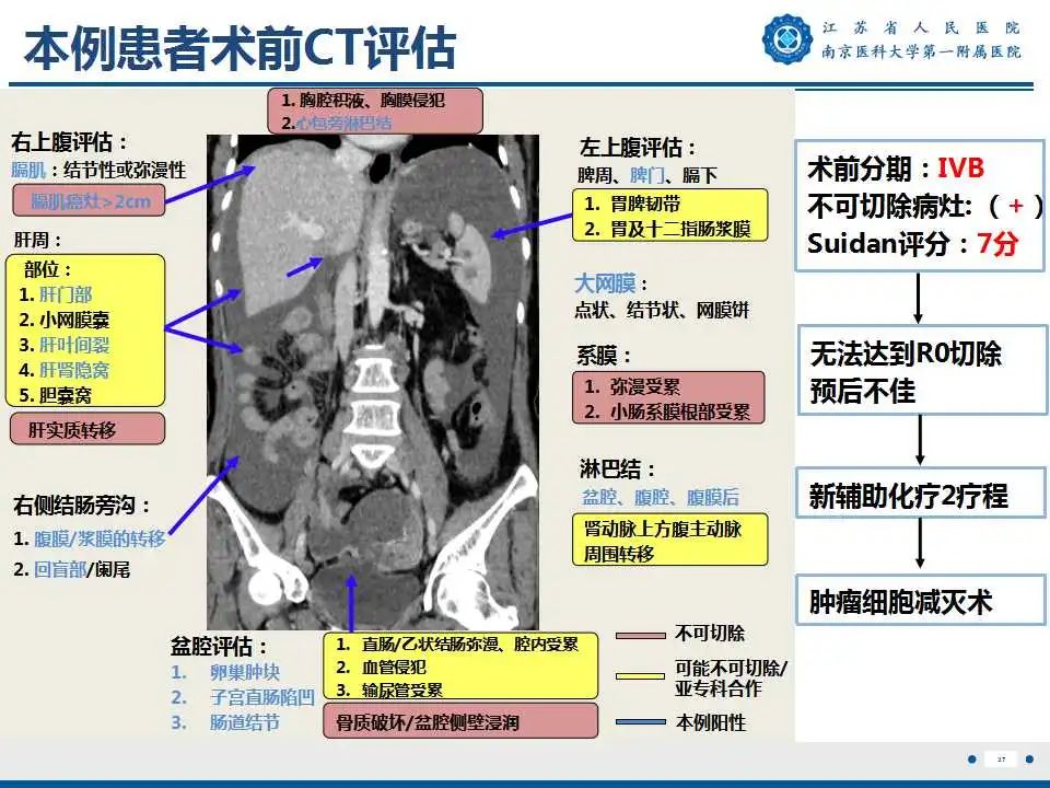 影像PPT - 【PPT】卵巢上皮癌-38