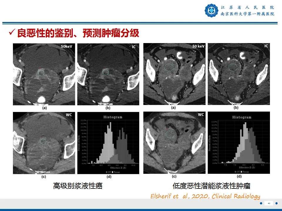 影像PPT - 【PPT】卵巢上皮癌-44