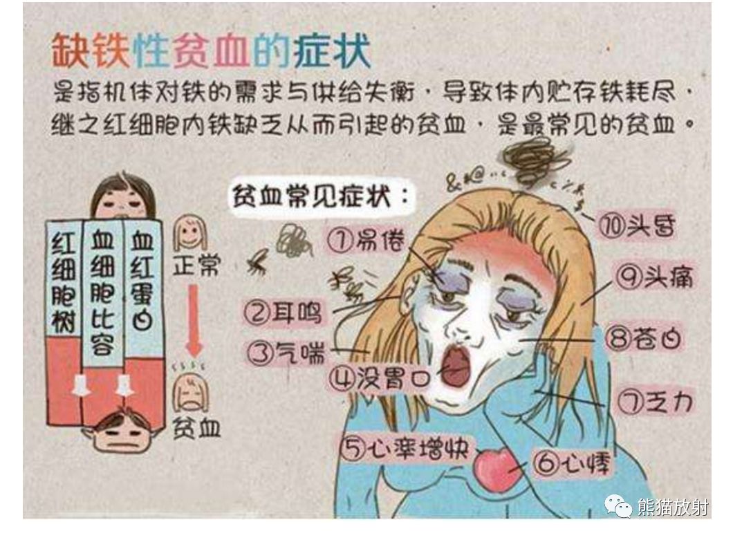 影像PPT - 贫血—胸部CT平扫的诊断价值-4 影像PPT - 贫血—胸部CT平扫的诊断价值-4