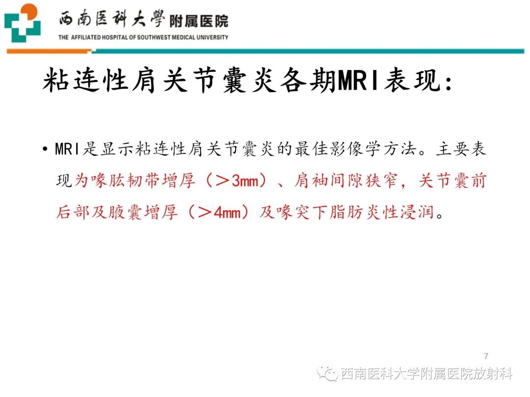 影像PPT - 【PPT】粘连性肩关节囊炎-7