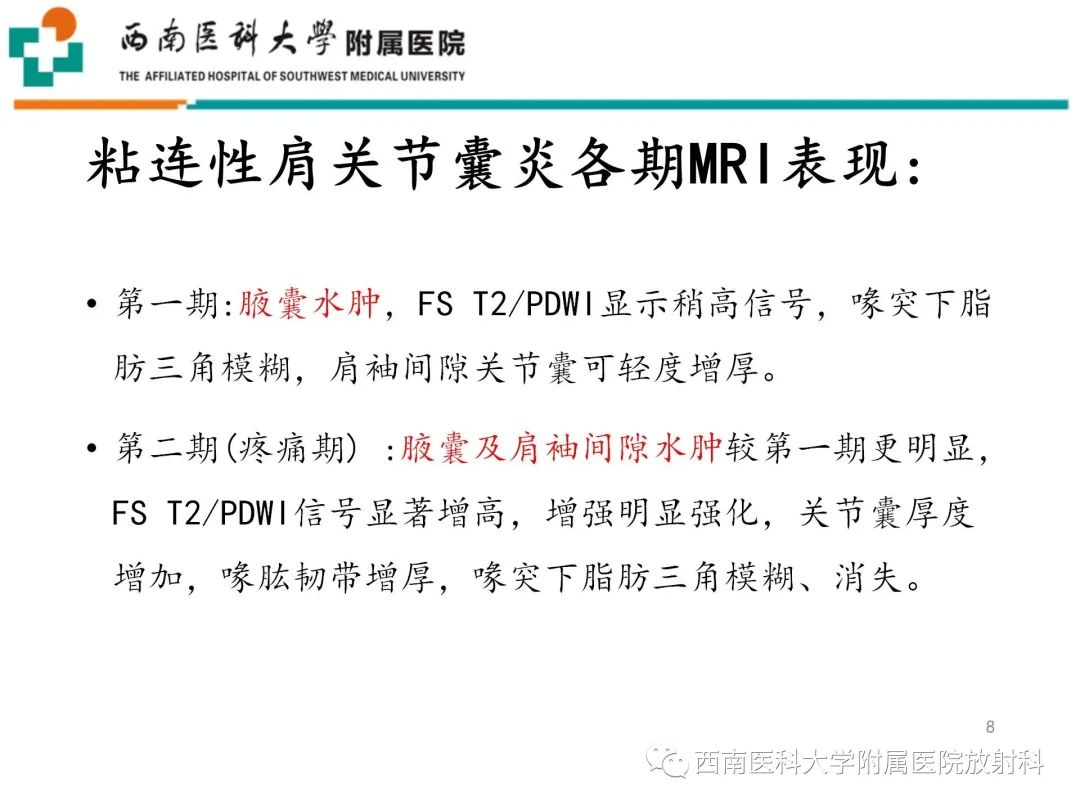 影像PPT - 【PPT】粘连性肩关节囊炎-8